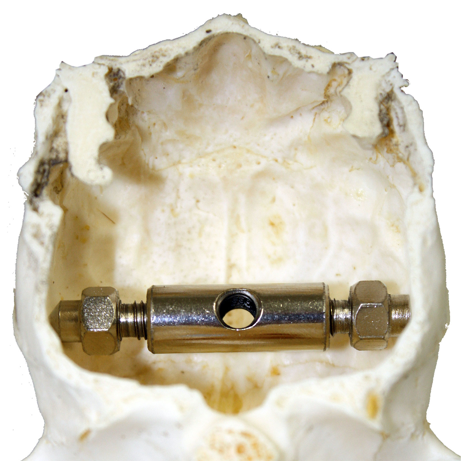 AKAH Trophäenbehandlung von Revieralarm Gehörnklammer für Hirsch 69922000
